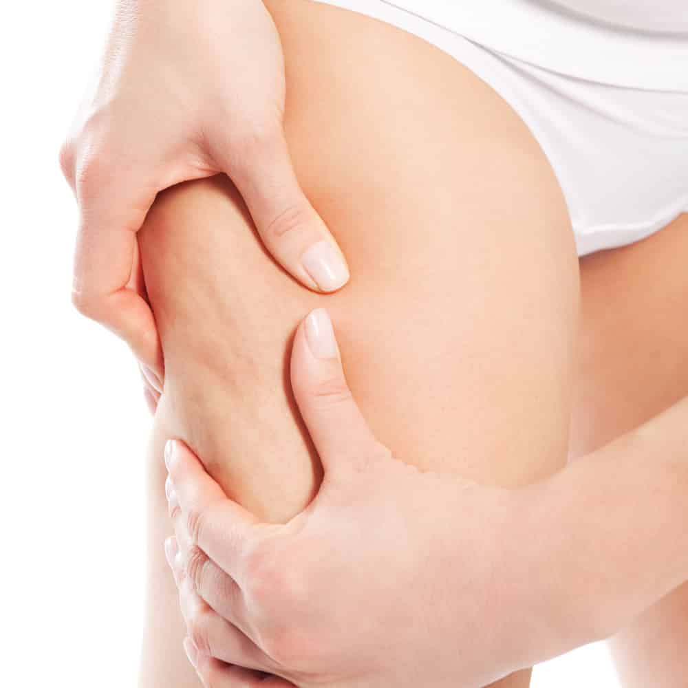 Traitement Cellulite Lyon
