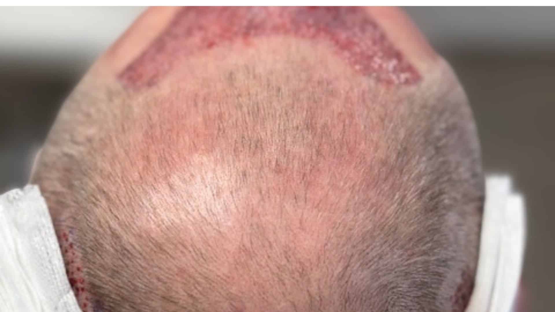 greffe fue docteur costa