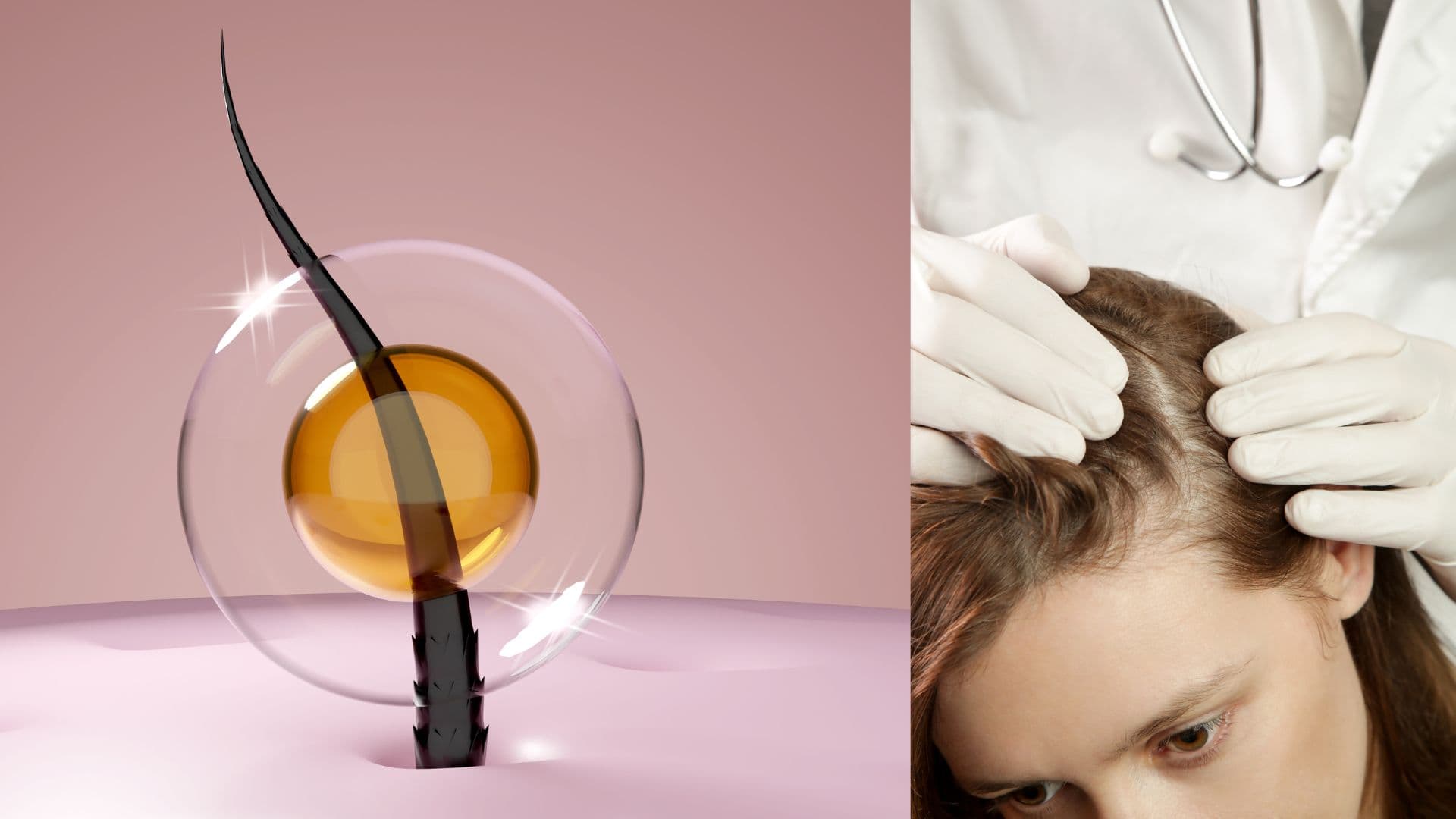 dermatologue repousse cheveux