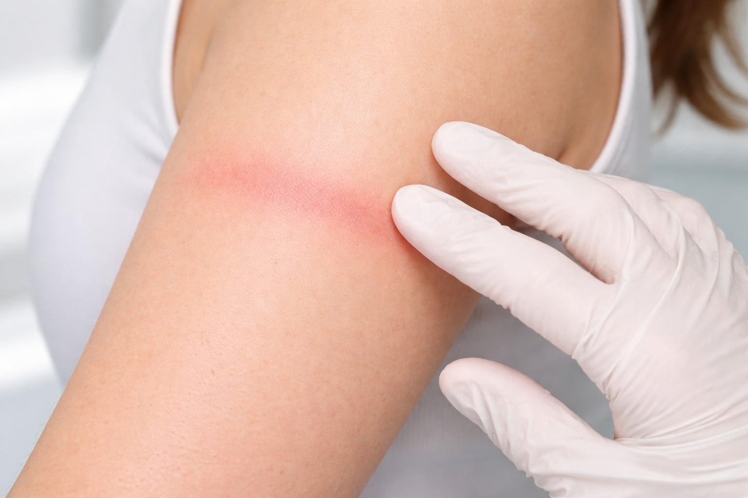 Épilation laser à Lyon : brûlure, cloques, rougeurs… quand faut-il consulter un médecin ?