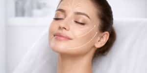 fils tenseurs à lyon