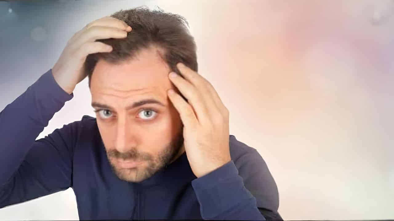 perte et chute de cheveux lyon