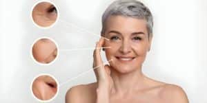 resurfacing - dr costa - lyon